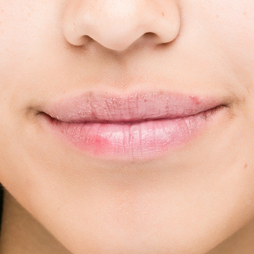 Labios