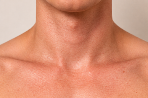 Cuello